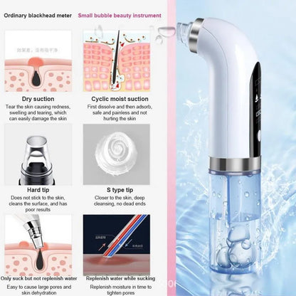Electric Blackhead Vacuum Remover